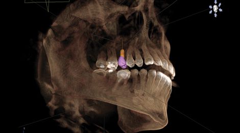 Escáner Dental 3D imagen digital tridimensional
