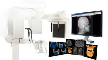 Escáner Dental 3D equipo de tomografías 
